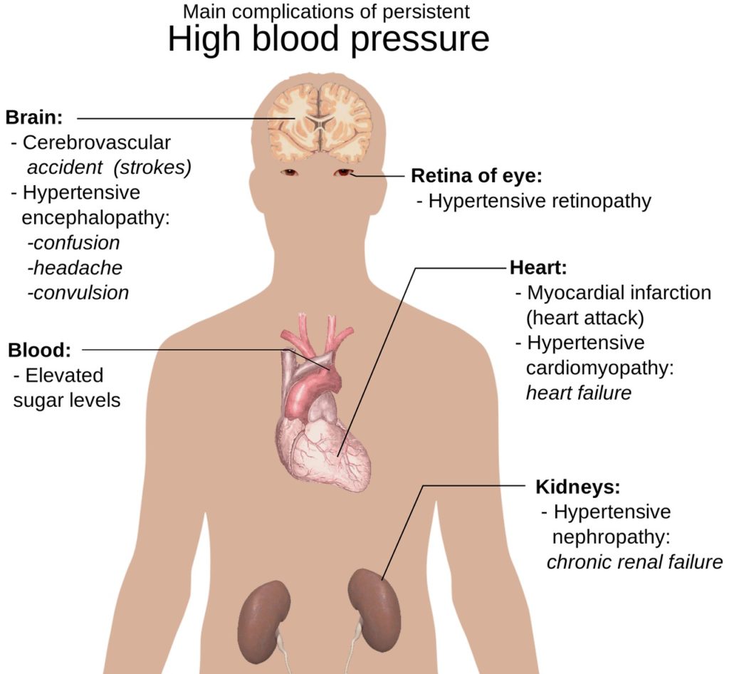 research article on hypertension